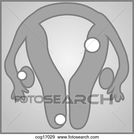 Stock Illustration - Reproductive tract, female, diseased. Fotosearch