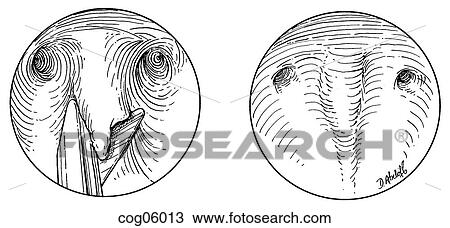 Drawing - Septate uterus, hysteroscopic incision, t. 2, pt. 2. Fotosearch