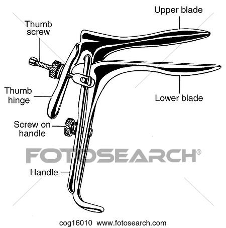 Clipart - Speculum, vaginal. Fotosearch