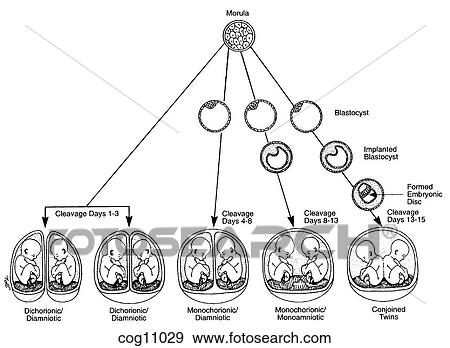 Twins, monozygotic placental types, cleavage View Large Illustration Stock Illustration - Twins, monozygotic placental types, cleavage. Fotosearch