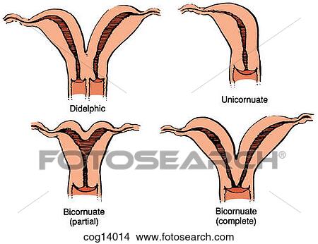 Stock Illustration - Uterus, double--part 1. Fotosearch