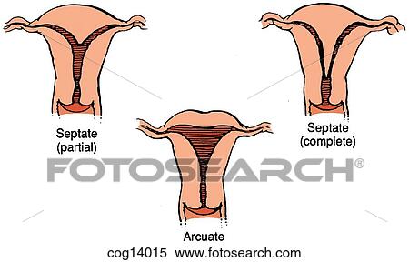 Uterus, double--part 2 View Large Illustration Stock Illustration - Uterus, double--part 2. Fotosearch