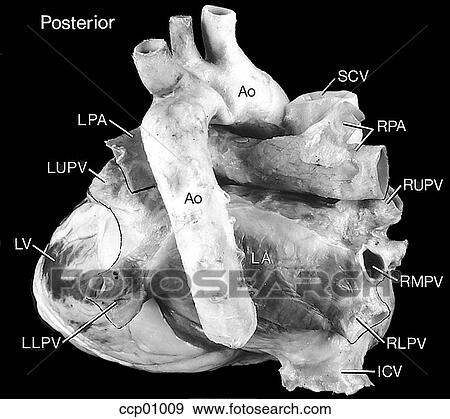 心臓 解剖学 外部である イラスト Ccp Fotosearch