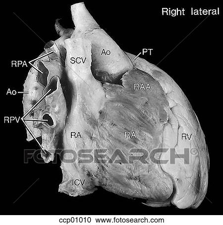 心臓 解剖学 外部である クリップアート 切り張り イラスト 絵画 集 Ccp Fotosearch