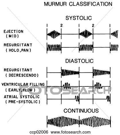 Stock Illustration - Auscultation, murmurs. Fotosearch