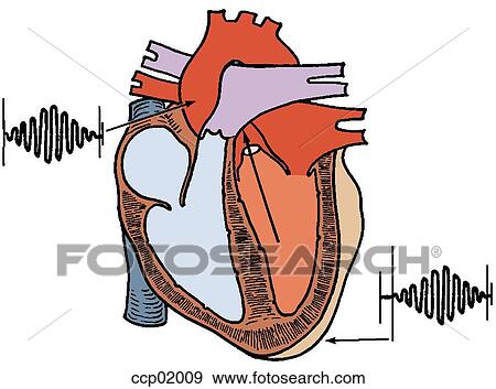 Auscultation, valvular aortic stenosis View Large Illustration Stock Illustration - Auscultation, valvular aortic stenosis. Fotosearch