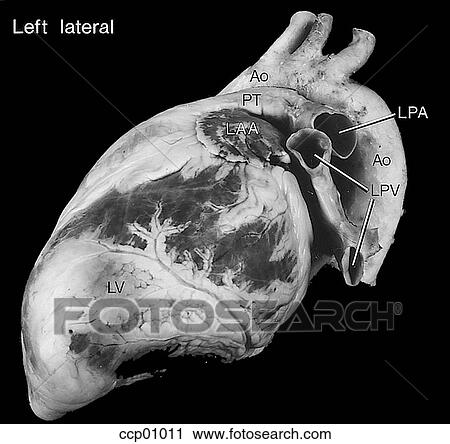 Clip Art - Cardiac anatomy, external. Fotosearch