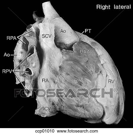Cardiac anatomy, external View Large Illustration Clipart - Cardiac anatomy, external. Fotosearch