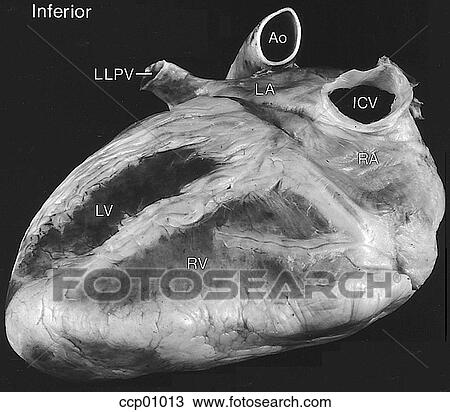Cardiac anatomy, external View Large Illustration Drawing - Cardiac anatomy, external. Fotosearch