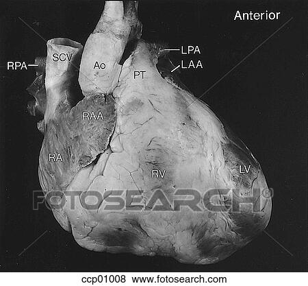 Cardiac anatomy, external View Large Illustration Stock Illustration - Cardiac anatomy, external. Fotosearch