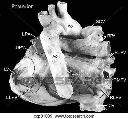 Cardiac anatomy, external View Large Illustration Stock Illustration - Cardiac anatomy, external. Fotosearch