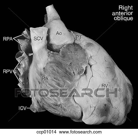 Stock Illustration - Cardiac anatomy, external. Fotosearch