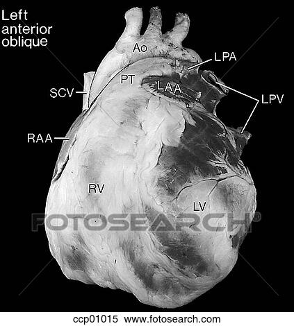 Stock Illustration - Cardiac anatomy, external. Fotosearch