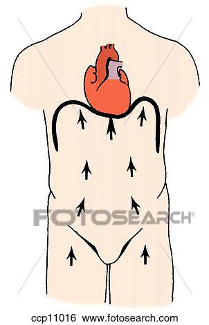 Cardiac rupture, hydraulic effect View Large Illustration Stock Illustration - Cardiac rupture, hydraulic effect. Fotosearch