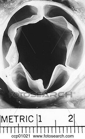 Cardiac valve, aortic View Large Illustration Clip Art - Cardiac valve, aortic. Fotosearch