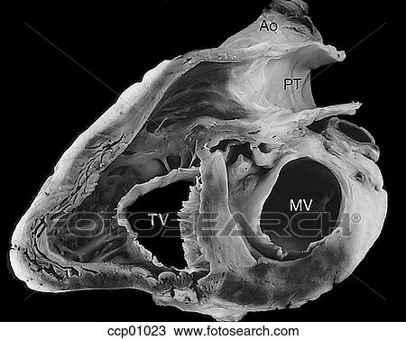 Cardiac valves, atrioventricular View Large Illustration Drawing - Cardiac valves, atrioventricular. Fotosearch