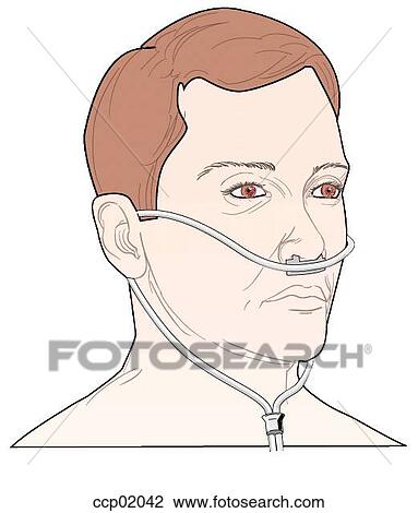 nasal cannula mask