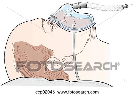 Stock Illustration - Face mask, ventimask. Fotosearch