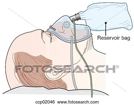 Stock Illustration - Face mask, with reservoir bag. Fotosearch
