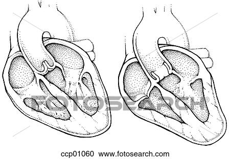 Clipart - Heart, contraction. Fotosearch
