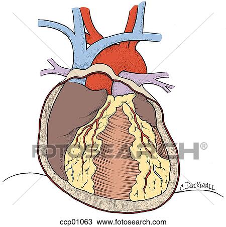 Heart, pericardium View Large Illustration Drawing - Heart, pericardium. Fotosearch