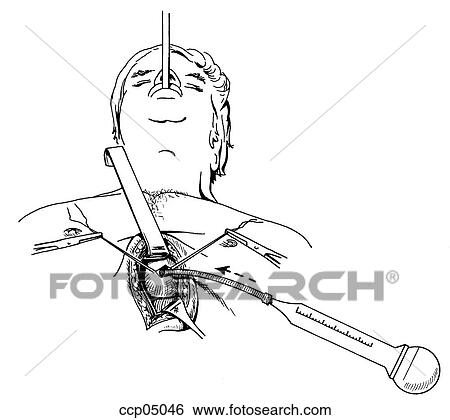 Irrigation View Large Illustration Stock Illustration - Irrigation. Fotosearch