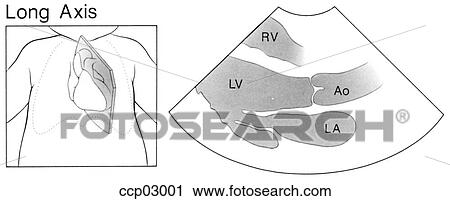 Long axis, heart View Large Illustration Clip Art - Long axis, heart. Fotosearch