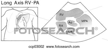 Drawing - Long axis, r. ventricle. Fotosearch