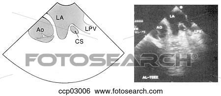 Plane, basal short-axis View Large Illustration Stock Illustration - Plane, basal short-axis. Fotosearch