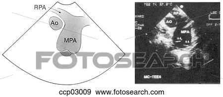 Plane, basal short-axis View Large Illustration Stock Illustration - Plane, basal short-axis. Fotosearch