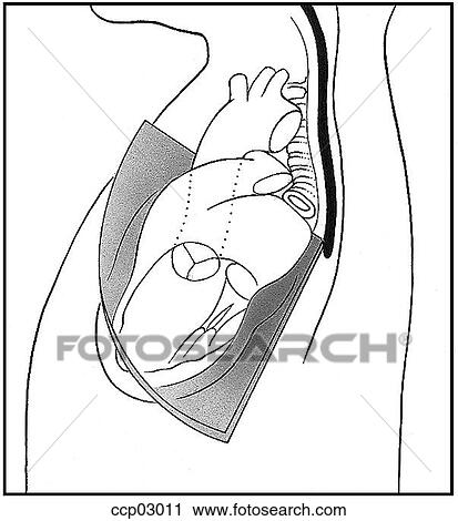 Plane, longitudinal View Large Illustration Clip Art - Plane, longitudinal. Fotosearch