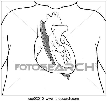 Plane, longitudinal View Large Illustration Clipart - Plane, longitudinal. Fotosearch