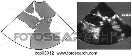 Plane, longitudinal View Large Illustration Drawing - Plane, longitudinal. Fotosearch