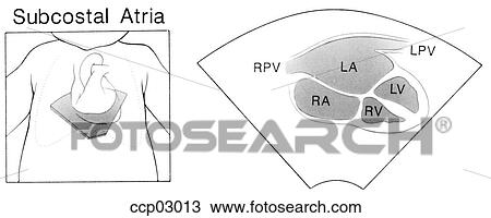 Plane, subcostal atria View Large Illustration Drawing - Plane, subcostal atria. Fotosearch