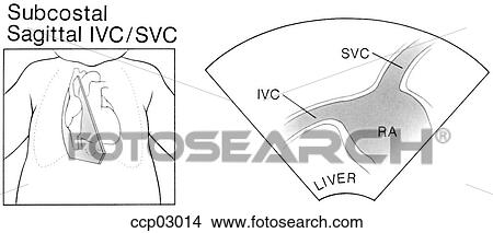 Stock Illustration - Plane, subcostal window. Fotosearch