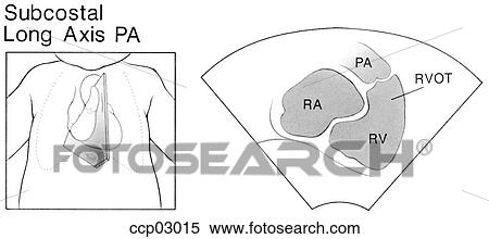 Plane, subcostal window View Large Illustration Stock Illustration - Plane, subcostal window. Fotosearch
