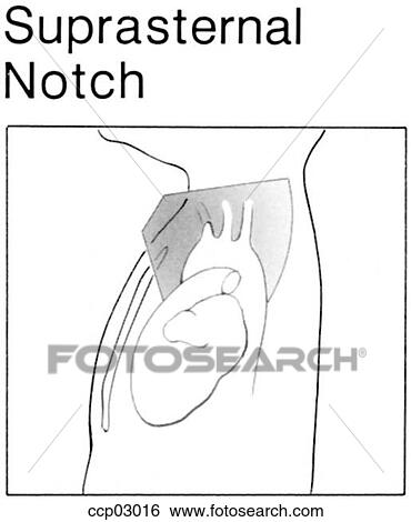 Plane, suprasternal View Large Illustration Stock Illustration - Plane, suprasternal. Fotosearch