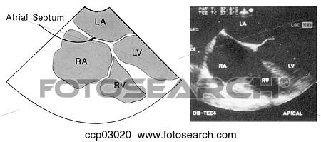Clipart - Plane, transverse. Fotosearch