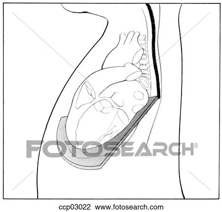 Drawing - Plane, transverse. Fotosearch