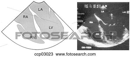 Drawing - Plane, transverse. Fotosearch