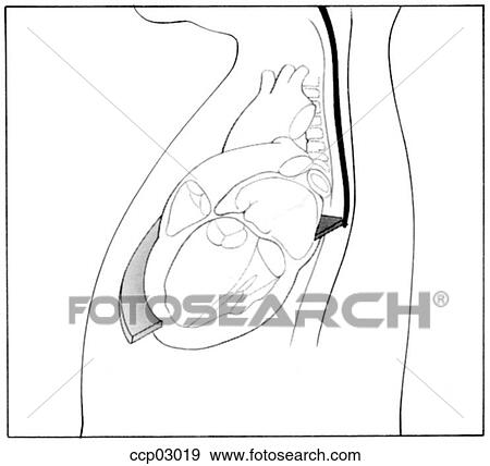 Plane, transverse View Large Illustration Stock Illustration - Plane, transverse. Fotosearch