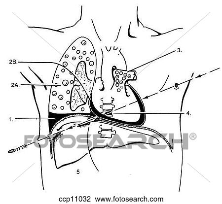 Drawing - Shock, mechanisms. Fotosearch