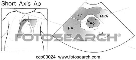 Short axis, aorta View Large Illustration Stock Illustration - Short axis, aorta. Fotosearch