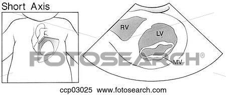 Short axis, l. ventricle View Large Illustration Stock Illustration - Short axis, l. ventricle. Fotosearch