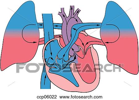 Drawing - Tetralogy of Fallot. Fotosearch