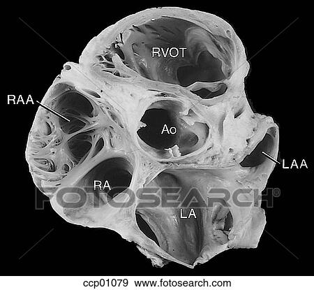 Stock Illustration - Valve, aortic. Fotosearch