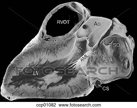 Valves, atrioventricular View Large Illustration Drawing - Valves, atrioventricular. Fotosearch