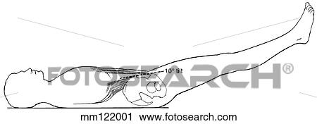 Clip Art - Abdominal muscle, action. Fotosearch