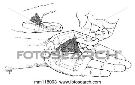 Adductor pollicis muscle View Large Illustration Drawing - Adductor pollicis muscle. Fotosearch