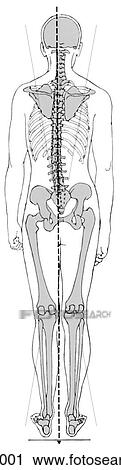 Clip Art - Alignment, faulty. Fotosearch